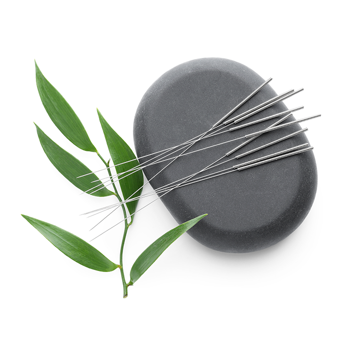 Agujas de acupuntura